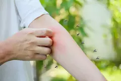 Как защититься от укусов насекомых